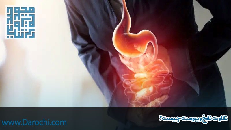 تفاوت نفخ و یبوست چیست؟